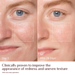 Magic Cream - before and after redness + texture infographic - model Emily