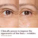 Magic Cream - before and after fine lines and wrinkles infographic - model Sarah