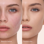 Airbrush Flawless Concealer - 5 medium before and after
