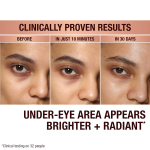 Before and after results of Shakira using Immediate Eye Revival Patches to reduce dark circles under eyes