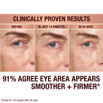Model before and afters from wearing Immediate Eye Revival Patches to reduce eye bags