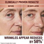 Before and after image showing anti-ageing results of mature skin model using Magic Cream for 28 days