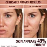 Magic Serum on light-tone model before and after