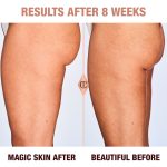 Results of Magic Body Cream after 8 weeks on a medium skin tone model