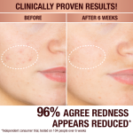 Charlottes Dark Spot Serum