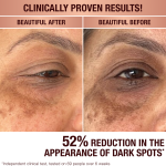 Charlottes Dark Spot Serum
